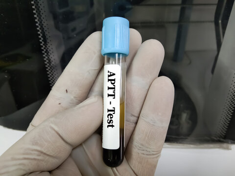 Blood Sample for Activated Partial Thromboplastin Time (APTT). Blood coagulation testing. Medical/health concept. PTT.