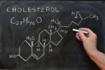 Mano escribiendo la fórmula molecular y estructural del colesterol en una pizarra