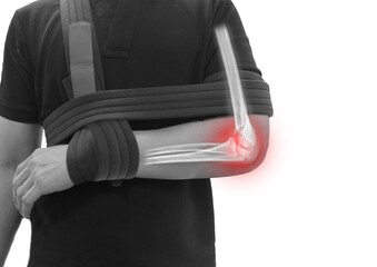 Close up forearm and elbow fracture pain in a man, Young man holding his forearm in pain elbow...
