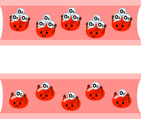 Obraz premium 酸素運搬量が減った赤血球、貧血