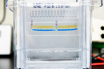 Protein ladder and protein samples on SDS-PAGE for interesting protein separation by mass