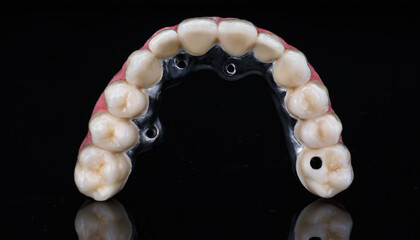 metal ceramic dental prosthesis of the upper jaw on black glass © Dental Pro Content