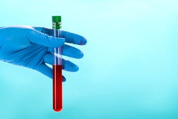 Hand of a doctor holding a bottle of blood sample