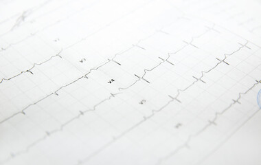 a card with a cardiogram of the heart. High quality photo