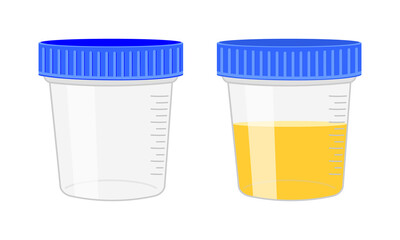 Urinalysis. Urine sample, empty and full plastic containers. Laboratory examination and diagnostics concept. Vector cartoon illustration.