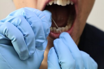 デンタルフロスで歯の隙間を掃除する人物