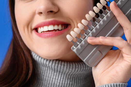 Young Woman With Teeth Color Chart, Closeup