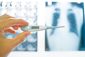 Focus selection Thermometer screen In the hospital there is an X-ray film in the background.Coronavirus(COVID-19) - 2019-nCoV Wuhan Virus Concept,