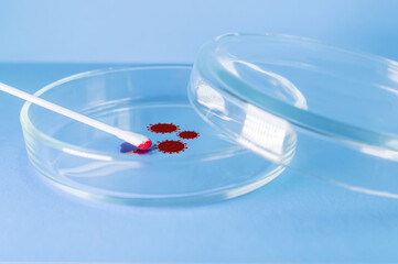 Medical laboratory. A cotton swab with virus-infected blood in a Petri dish on a blue background....