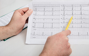 Cardiogram test, close-up of ECG report. Doctor analyzes cardiogram results of a patient's heart...