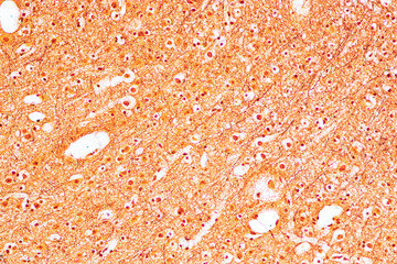 Education Spinal cord, Nerve, Cerebellum, Cortex and Motor Neuron Human under the microscope in Lab.
