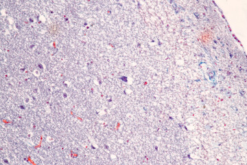 Education Spinal cord, Nerve, Cerebellum, Cortex and Motor Neuron Human under the microscope in Lab.

