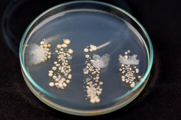 Mold Beautiful, Colony of Characteristics of Fungus (Mold) in culture medium plate from laboratory microbiology.
