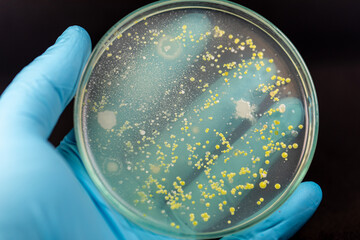 Mold Beautiful, Colony of Characteristics of Fungus (Mold) in culture medium plate from laboratory microbiology.
