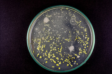 Mold Beautiful, Colony of Characteristics of Fungus (Mold) in culture medium plate from laboratory microbiology.
