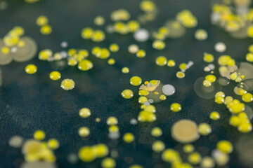 Mold Beautiful, Colony of Characteristics of Fungus (Mold) in culture medium plate from laboratory microbiology.
