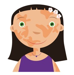Girl with vitiligo on a white background
