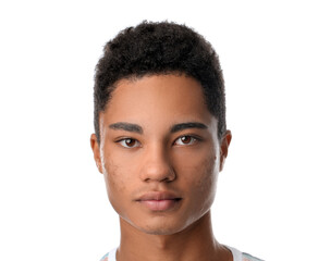 African-American teenage boy with acne problem on white background