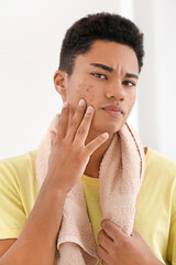Fototapeta na wymiar African-American teenage boy with acne problem at home