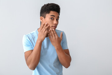 African-American teenage boy with acne problem on light background