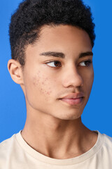 Obraz premium African-American teenage boy with acne problem on color background