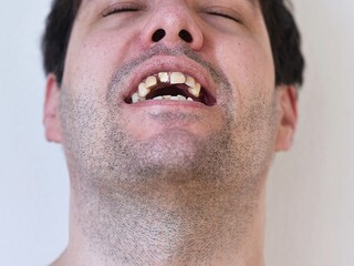 portrait of a man with broken teeth
