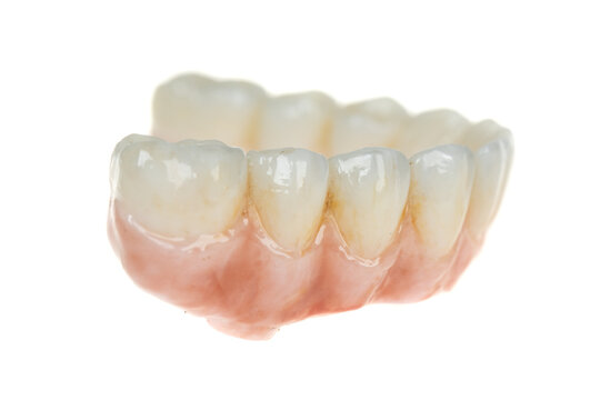 Dental health care. Ceramic zirconium in final version. Close up dental prosthesis on zirconium oxide implants, isolated on white. Side view