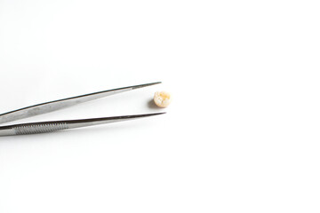 Baby tooth in tweezers. Molar in man hand over white background. Kids an oral hygiene concept with copy space.