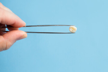 Human hand holding baby tooth in tweezers. Molar in man hand over blue background. Kids an oral hygiene concept with copy space.