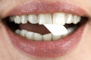 Chewing gum in a woman's teeth, close-up.