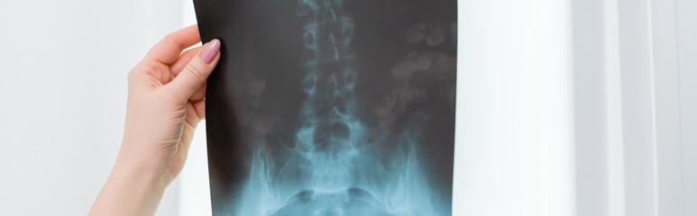 partial view of rehabilitologist holding x-ray diagnosis, banner