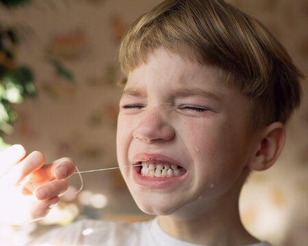 little kid with tears on his face close-up. boy tries to pull out his baby tooth with thread