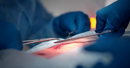 Close up of doctor stitching incision with retention suture and sterile needle