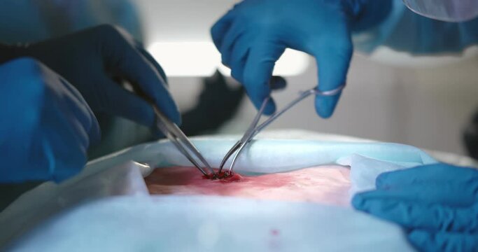 Close up o surgeons in gloves holding scissors and extracting bullet out of patient