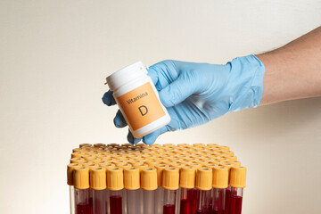 hand with protective nitrile glove holding syringe with blood collection tubes