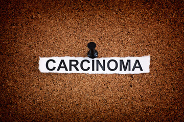 Torn piece of paper with the word Carcinoma pinned on a cork board