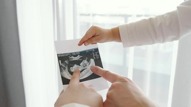 Expecting a baby, looking at sonogram close up
