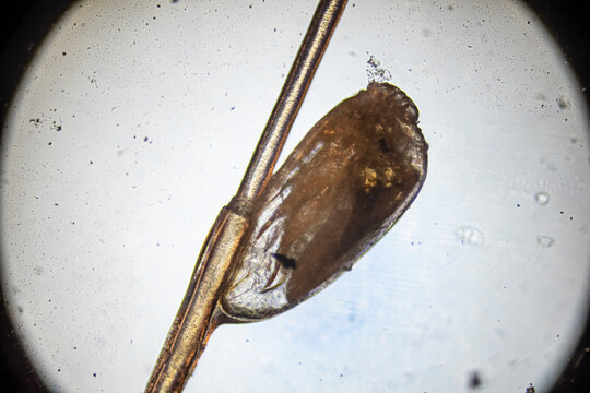 Gnida - jajo wszy przyczepione do włosa