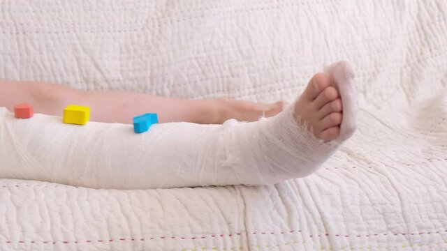 broken leg. Close-up of the cast on the feet. colored toys on top