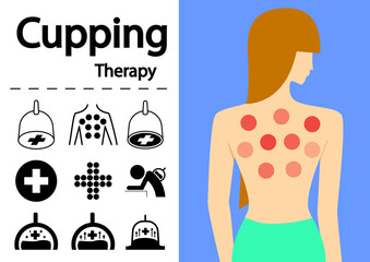 Hijama or Cupping Therapy Icons in flat vector art