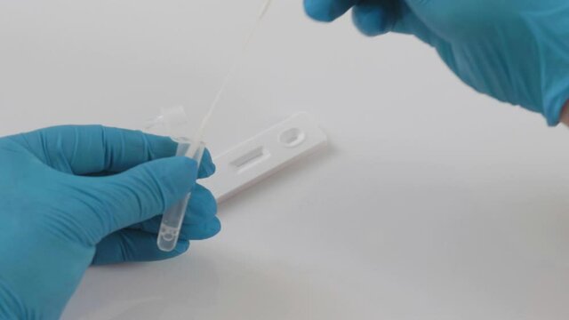 COVID-19 Coronavirus SARS-CoV-2 rapid swab laboratory test procedure
