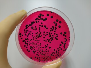 Food and drug microbial test results