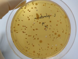 Food and drug microbial test results