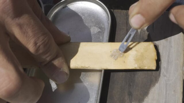 Man preparing kambo amazon frog poison medicine for body detox