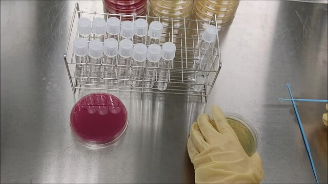Making Staphylococcus aureus suspension strain