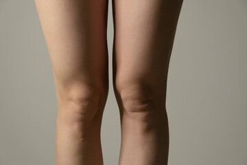 Fototapeta premium Overweight knees, contrast lightning. Woman`s hips closeup raw studio shot in grey background. Dieting and fat loss concept.