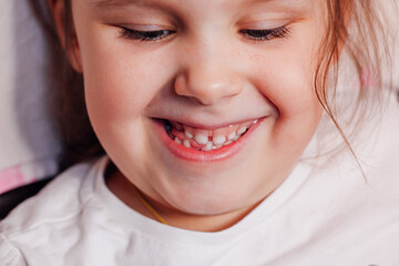 close-up the mischievous, joyful face of a girl with a hole in the bottom row of teeth from the...