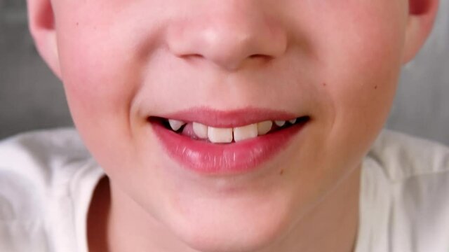 smile and laugh of a teenage boy, white teeth are visible, one baby tooth is missing, close-up, 4k video, shooting with hands