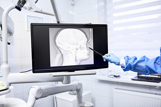 Specialist watching images of skull and spine at x-ray film viewer,. Diagnosis, treatment planning. Dentist office 