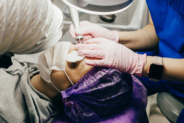 The doctor of the cosmetologist carries out the procedure to remove the birthmarks of the laser.